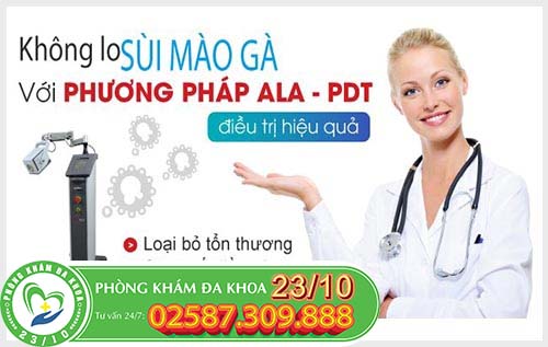 hỗ trợ điều trị sùi mào gà bằng phương pháp ALA-PDT